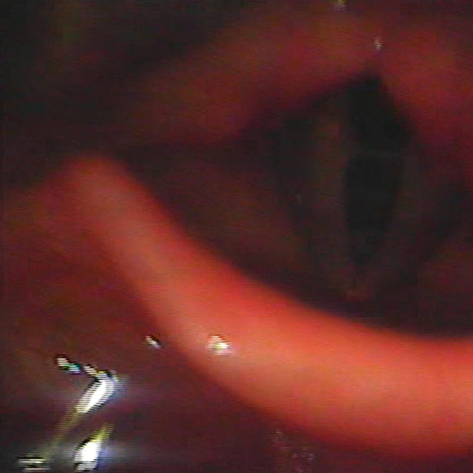 EP ROSABEGE - Rerererê!2 master 2021